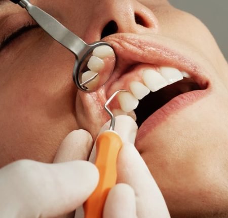 LANAP laser therapy for gum disease treatment at Dr. Safar's clinic.